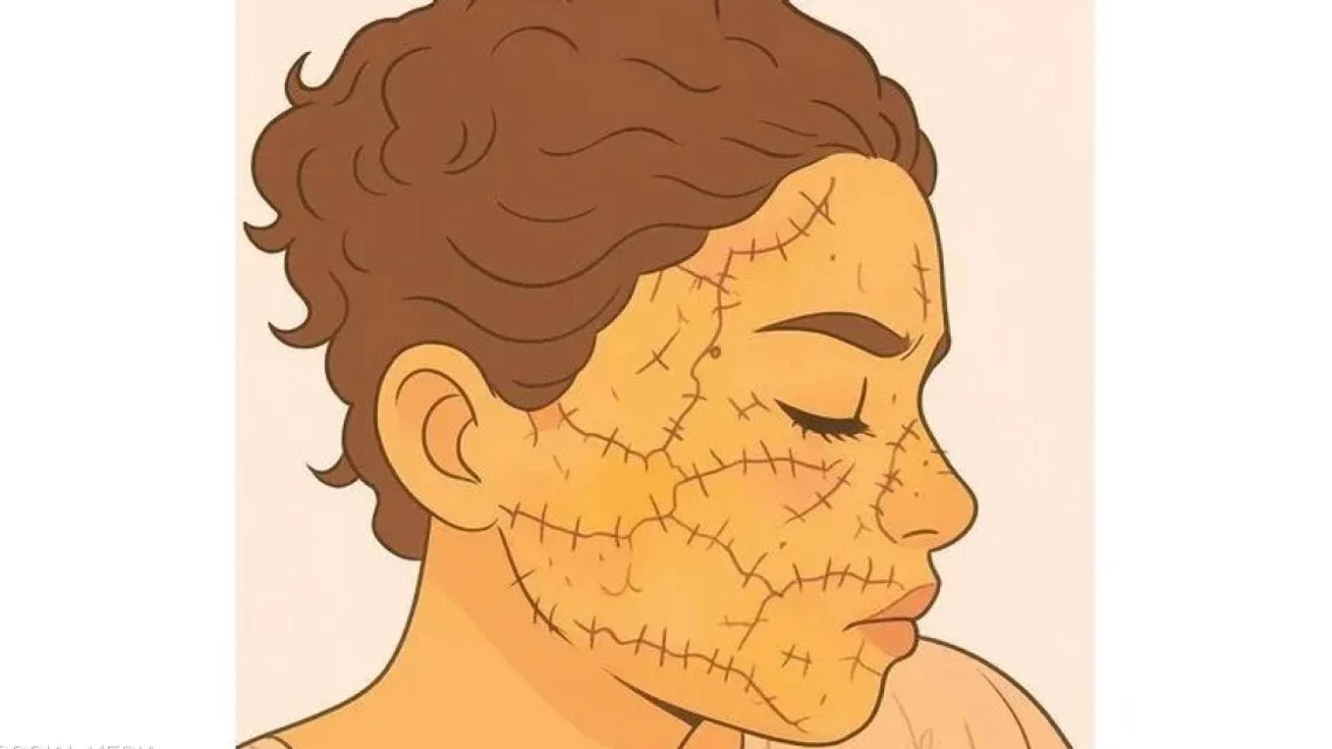 جريمة تهز المغرب.. رجل يشوه وجه طليقته بسلاح أبيض ومطالبات حقوقية بمحاكمة صارمة