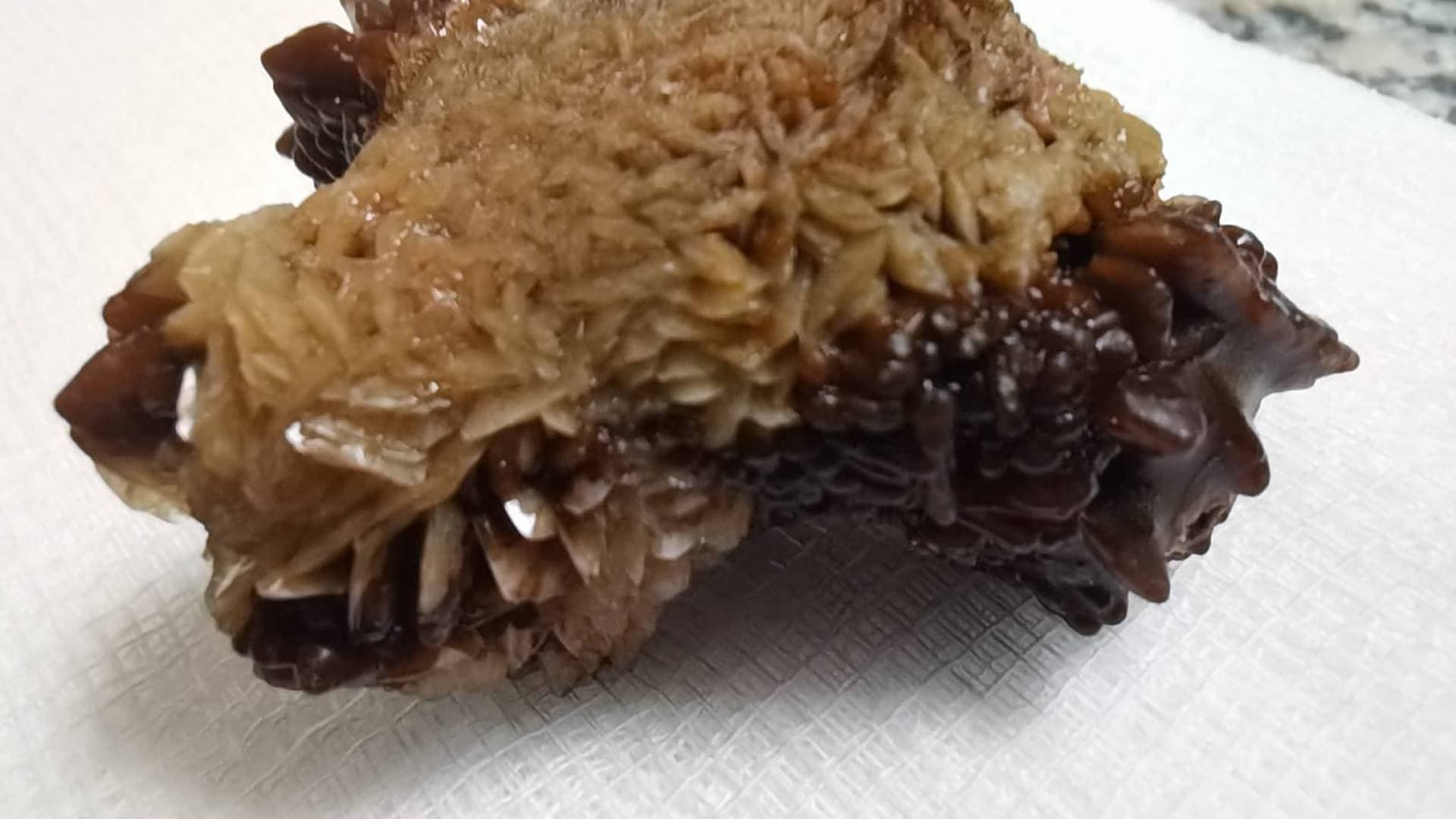 "لأول مرة في الأردن".. نجاح عملية نوعية بالمنظار لاستخراج حصوة 4 سم بمستشفى النديم