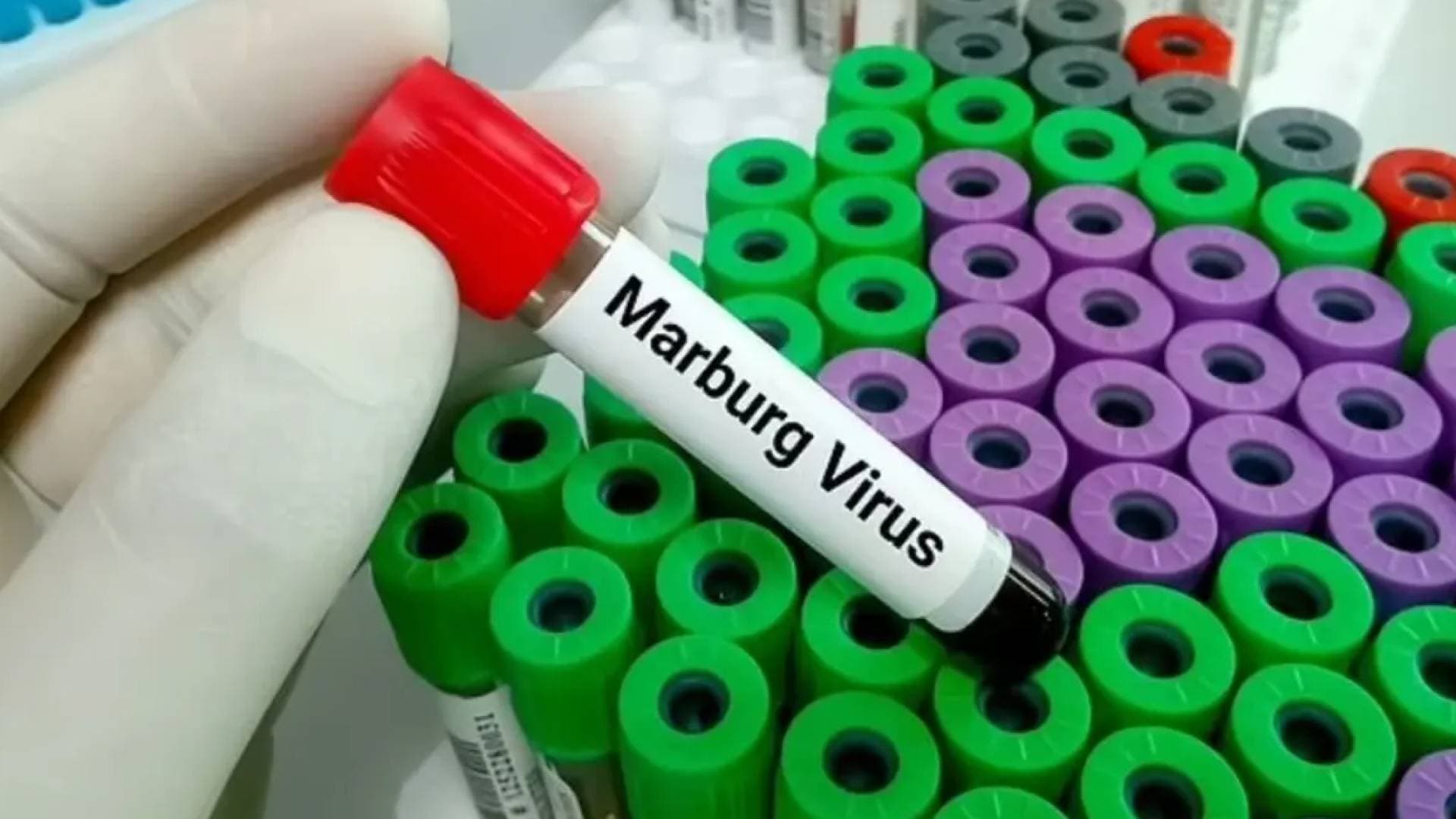 "الصحة المصرية" تعلق على مخاوف انتشار "فيروس ماربورغ" في مصر