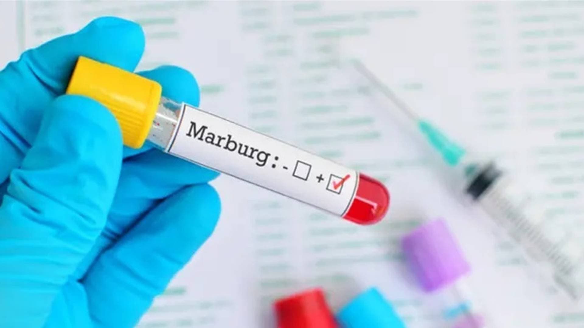 السلطات المصرية تعلن التأهب لمواجهة "فيروس ماربورغ"