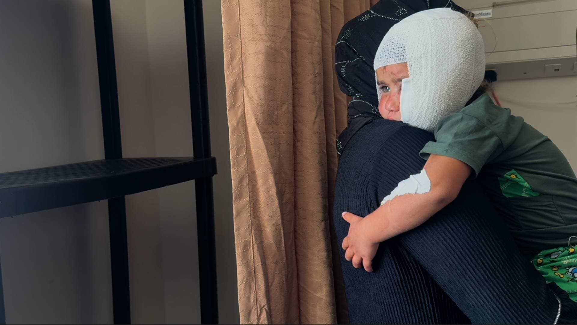 مراسل رؤيا: كلب يعقر 4 أشخاص بالبادية الشمالية ويشوه وجة طفلة
